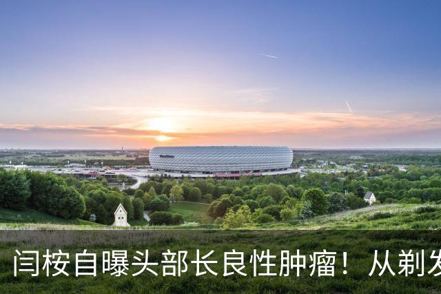 闫桉自曝头部长良性肿瘤！从剃发上手术台到《嫁金钗》播出